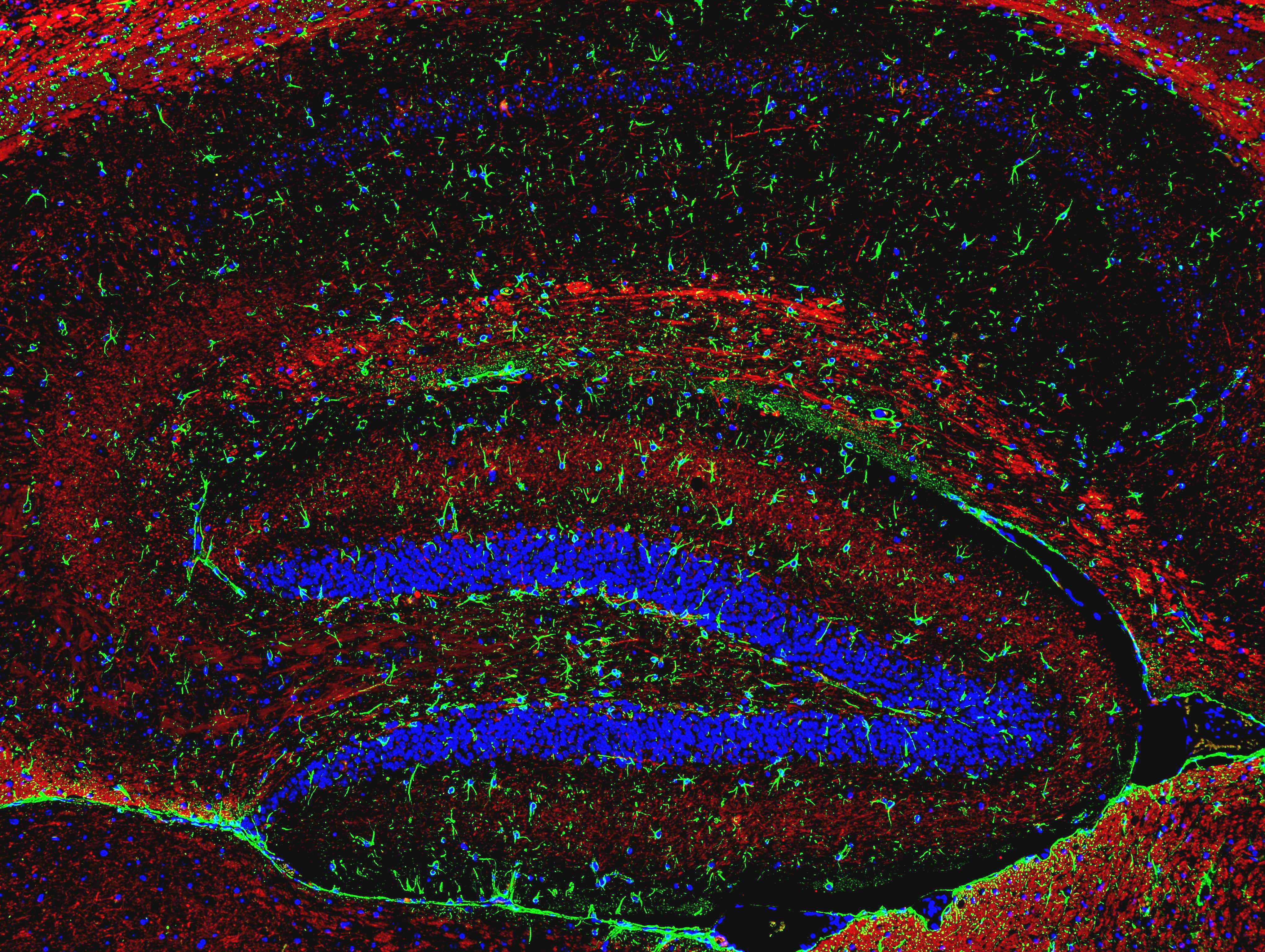 Neuronalastrocytic network of the mouse hippocampus