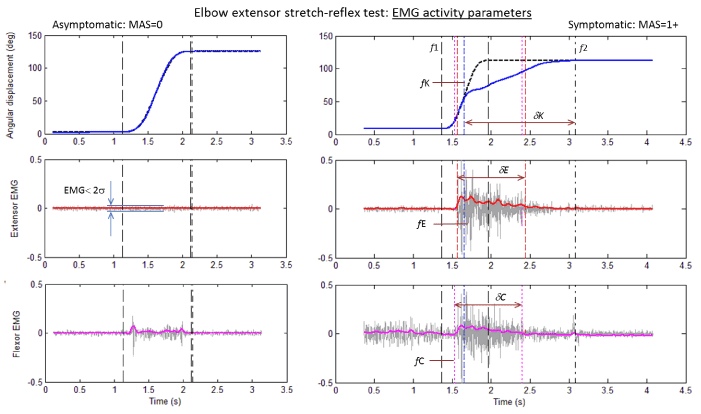 Quantification of elbow muscle tone from an instrumented manual stretch