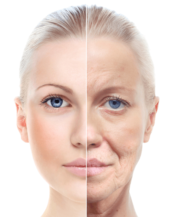 Beverly Hills CA Best Facial Skin Tightening Treatment Los Angeles