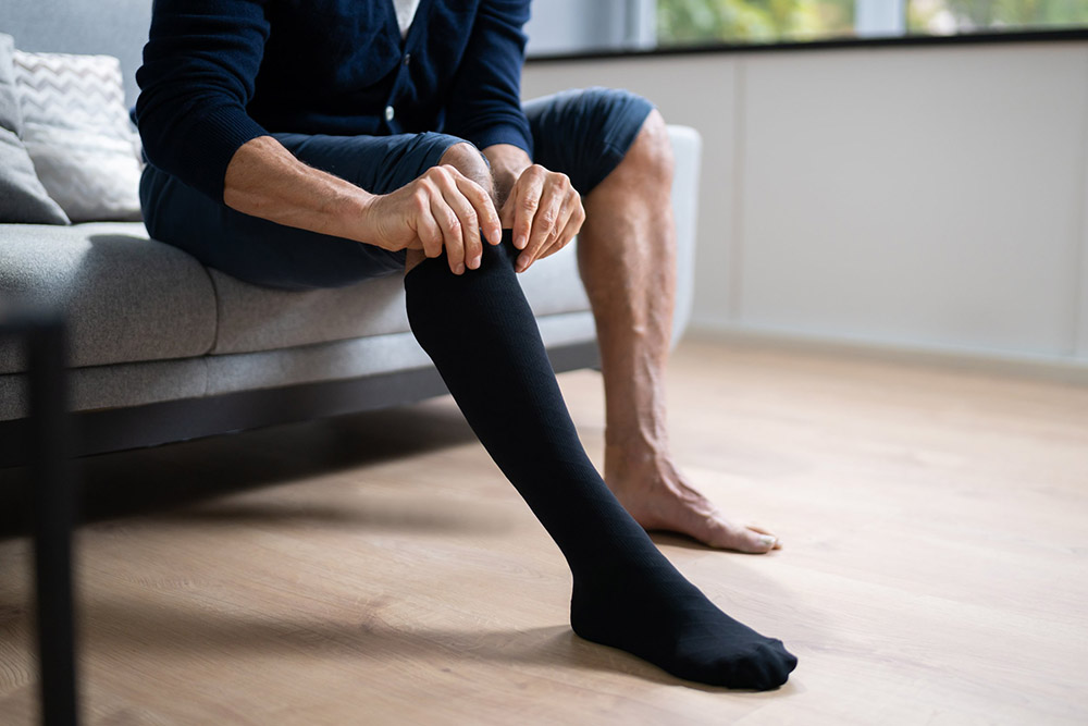 The Role of Compression Stockings in Varicose Vein Treatment and