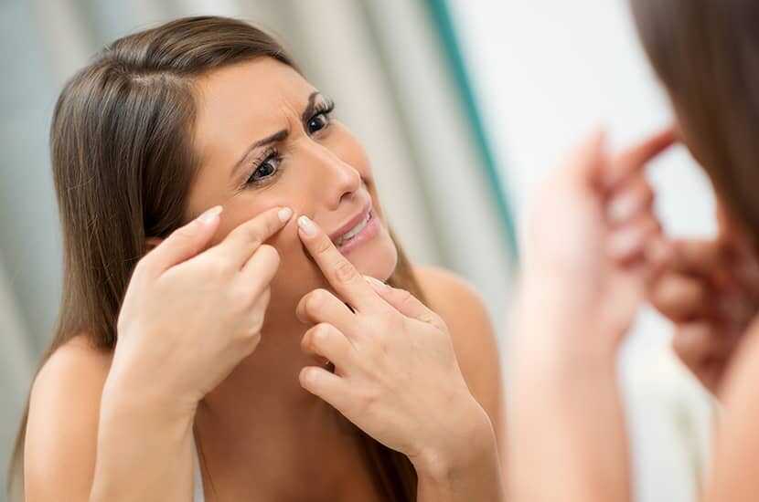 7 Key Benefits Of Steaming Your Face For Acne [Step By Step Process]