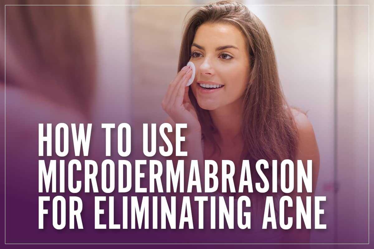 How You Can Benefit From Using Microdermabrasion To Eliminate Acne