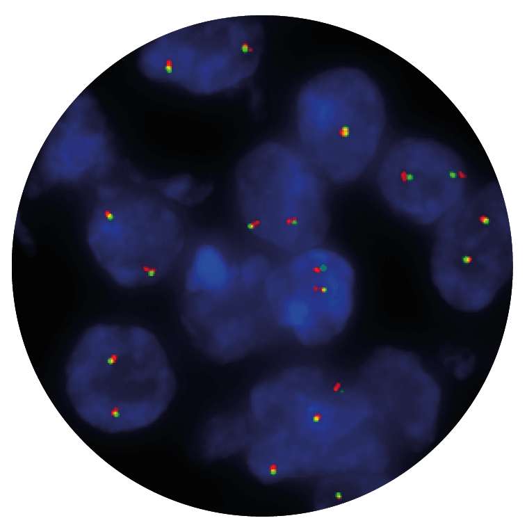 CytoCell ALK Breakapart FISH Probe OGT