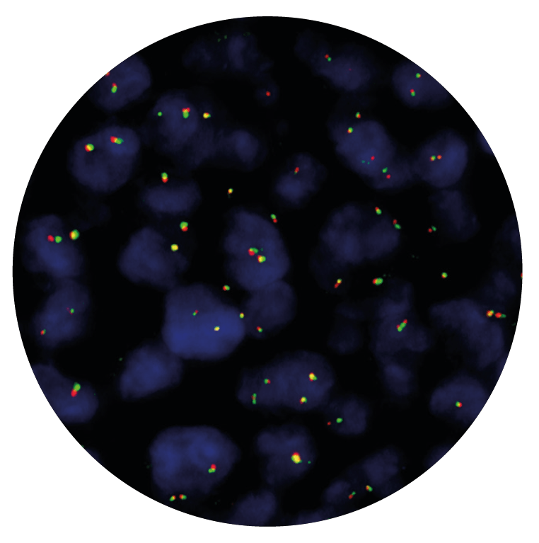 CytoCell IGH Breakapart FISH Probe (Solid Tumor) OGT