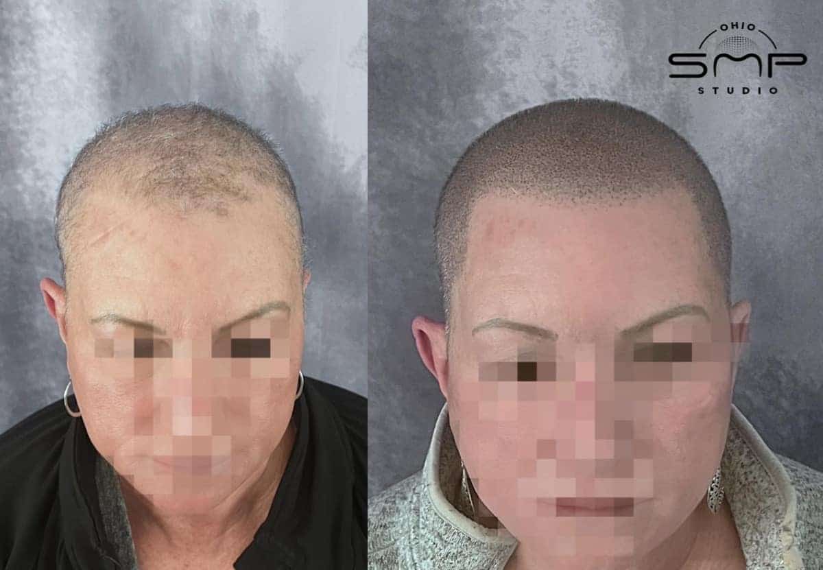 Discover the Right Way to Wash Your Hair for Healthy Hair Growth