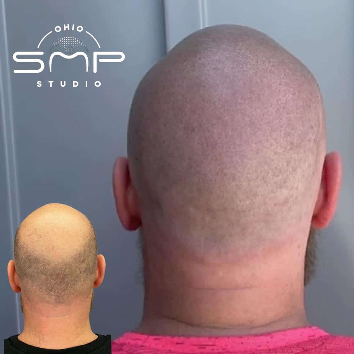 Unlocking Healthy Scalp Care Expert Strategies in Columbus, OH