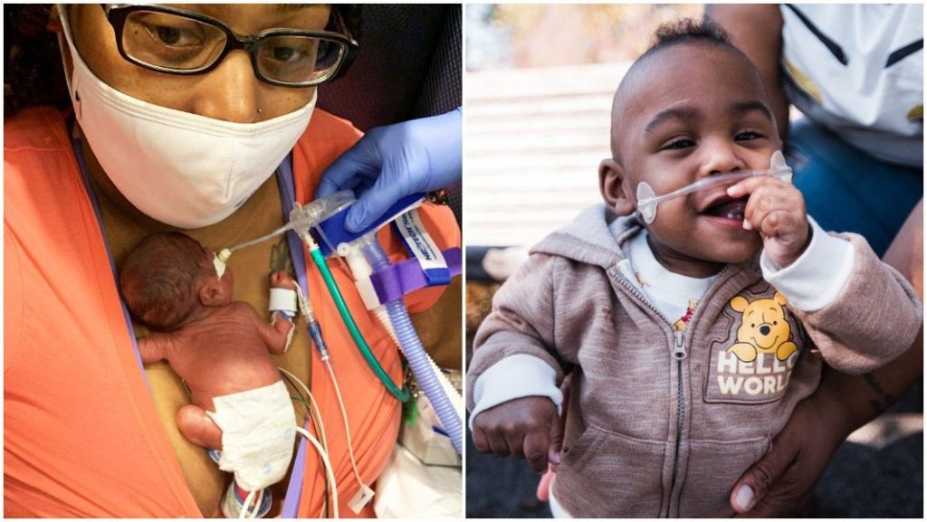 8 Youngest Premature Baby to Survive in History
