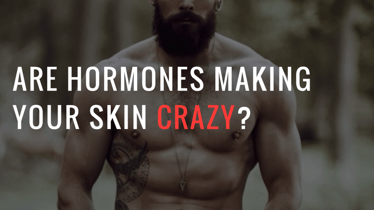 ARE HORMONES MAKING YOUR SKIN CRAZY? My Interview With An Expert