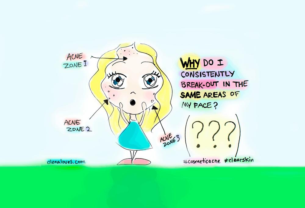 Why Do I Always Break Out In the Same Place?