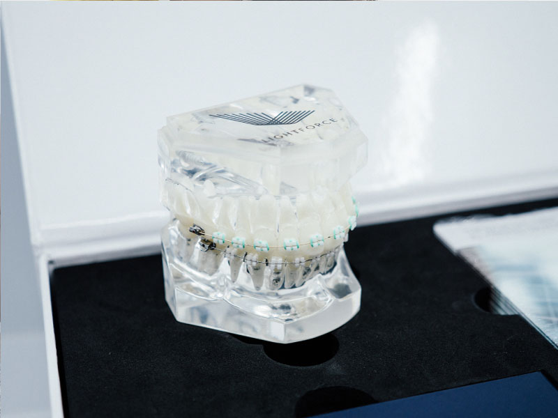 LightForce Braces in O’Fallon, IL Olson Orthodontics