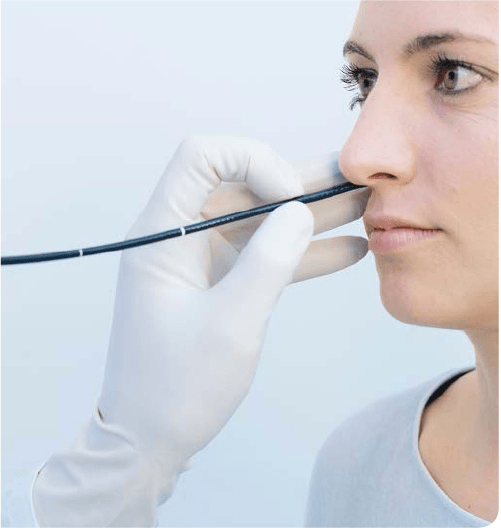 OfficeBased Laryngoscopy Good Practicing Laryngoscopy Part2 Olympus