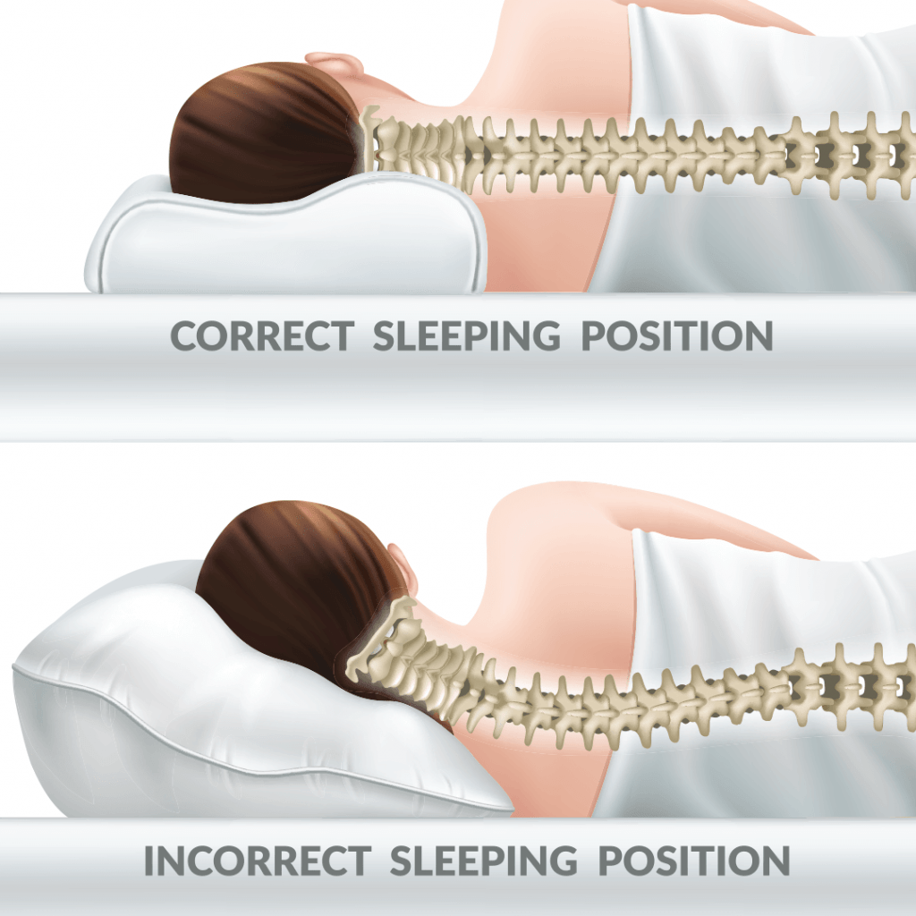 How To Live With Lower Neck Pain Or How Do You Live With