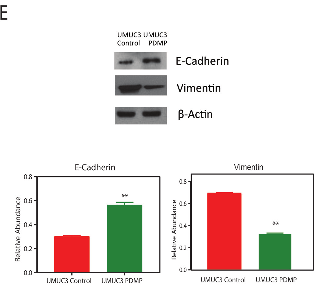 Correction Expression of ganglioside GD2, reprogram the lipid