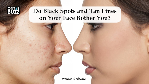 Do Black Spots and Tan Lines on Your Face Bother You?