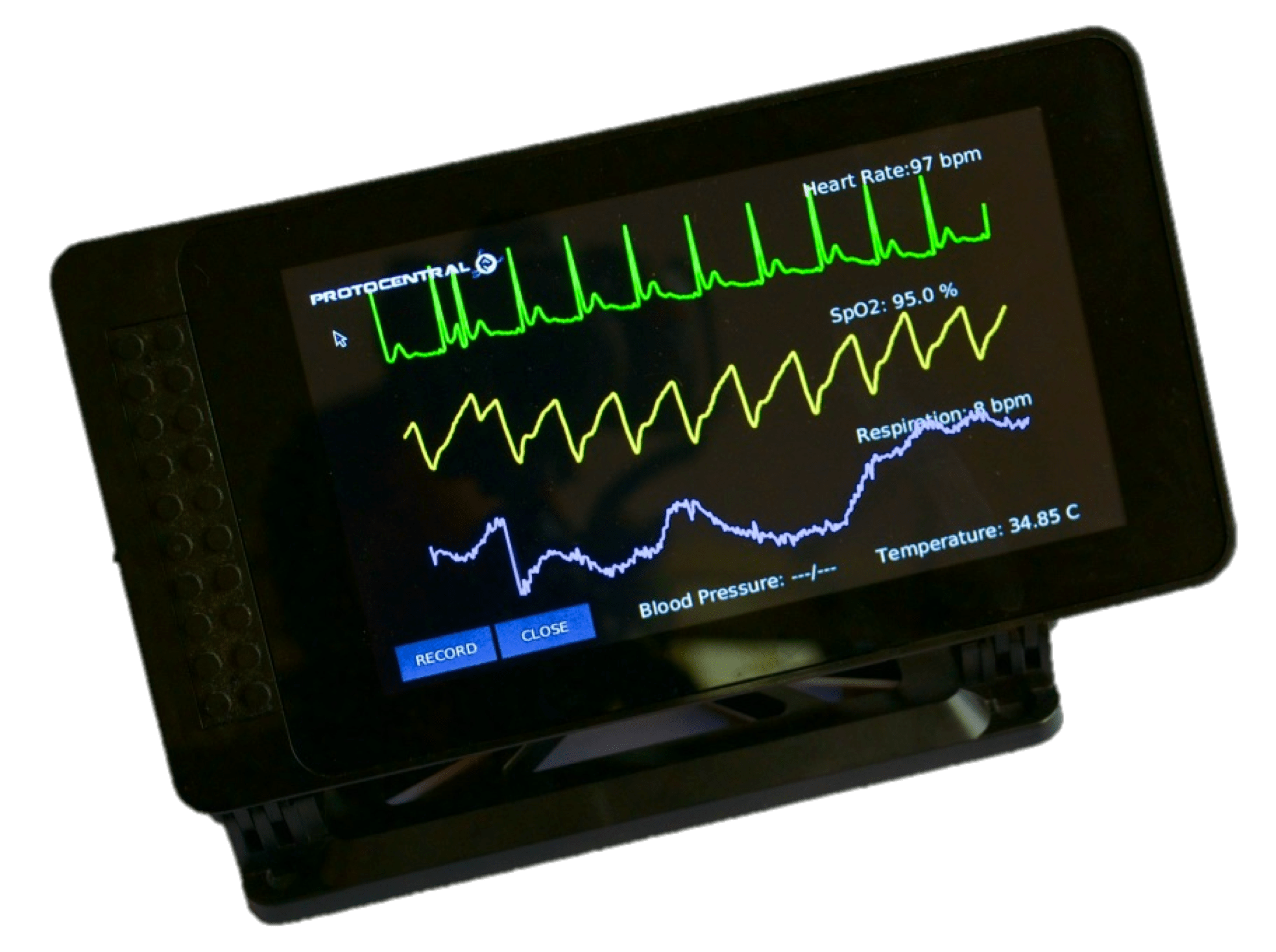 Remote Patient Monitoring? Now It’s Possible! Open Electronics Open