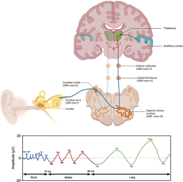 Evoked Potentials Modalities and Anesthetic Effects OpenAnesthesia