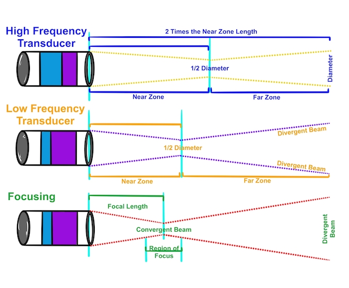 Principles of Ultrasound OpenAnesthesia