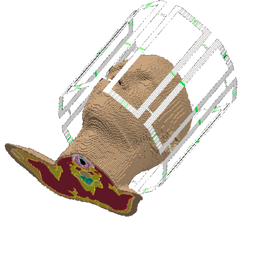 8channel transmit/receive RF coil for 3T Open Source Imaging
