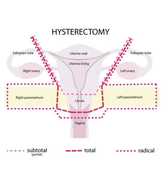 Blog Posts The Operating Room Global