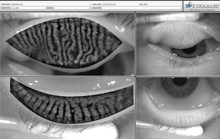 eyeball2 | The Optical Journal