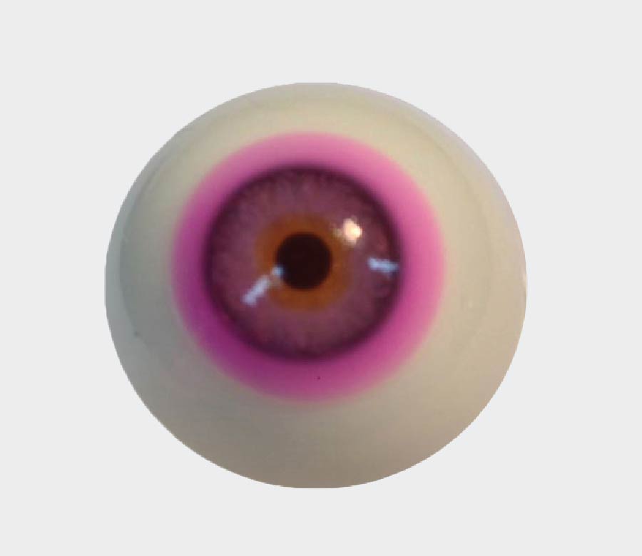 Contact Lenses For Color Blindness The Optical Journal