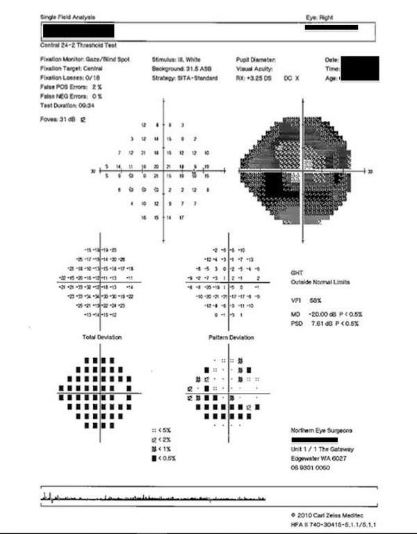 visualfieldreport2 視力中心（香港）有限公司