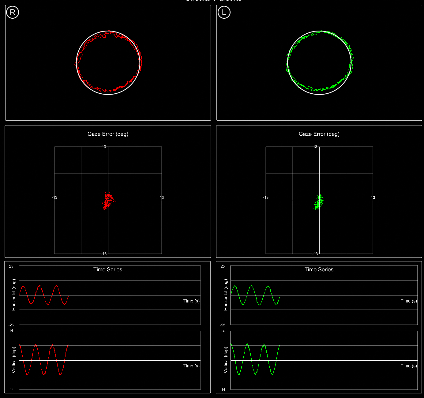 Optics Tracker - Vision Tracking