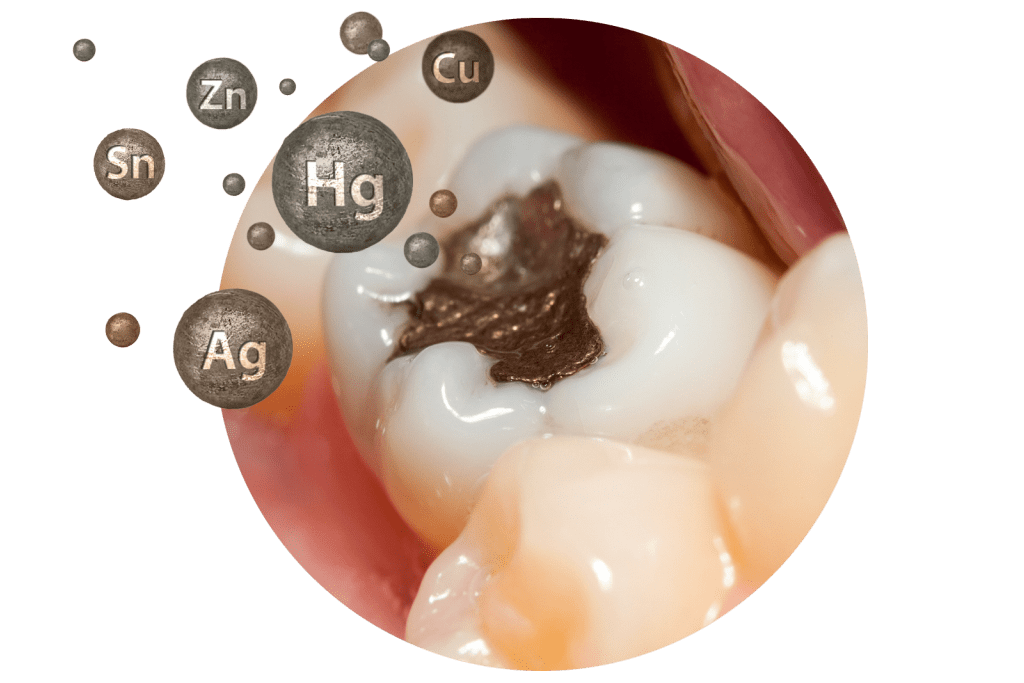Amalgam znanstveno dokazano škoduje človeškemu telesu Optimizacija Članki