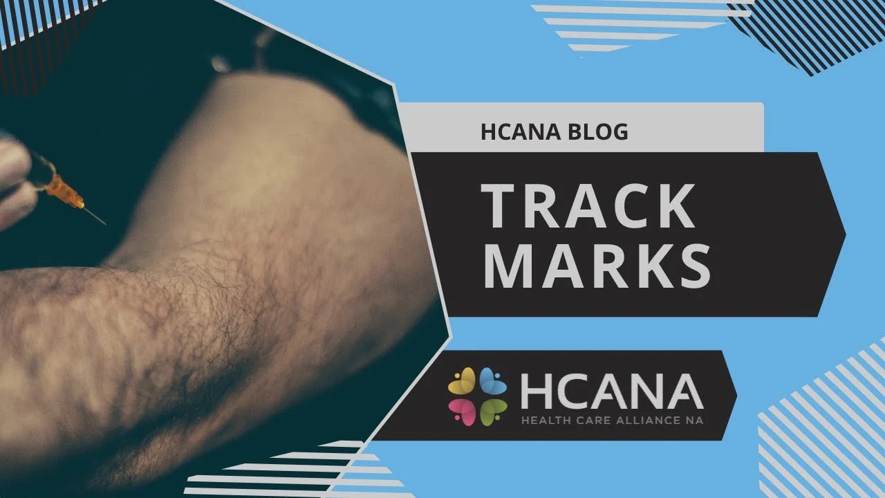 What are Track Marks? An Informative Guide Oasis Recovery Center