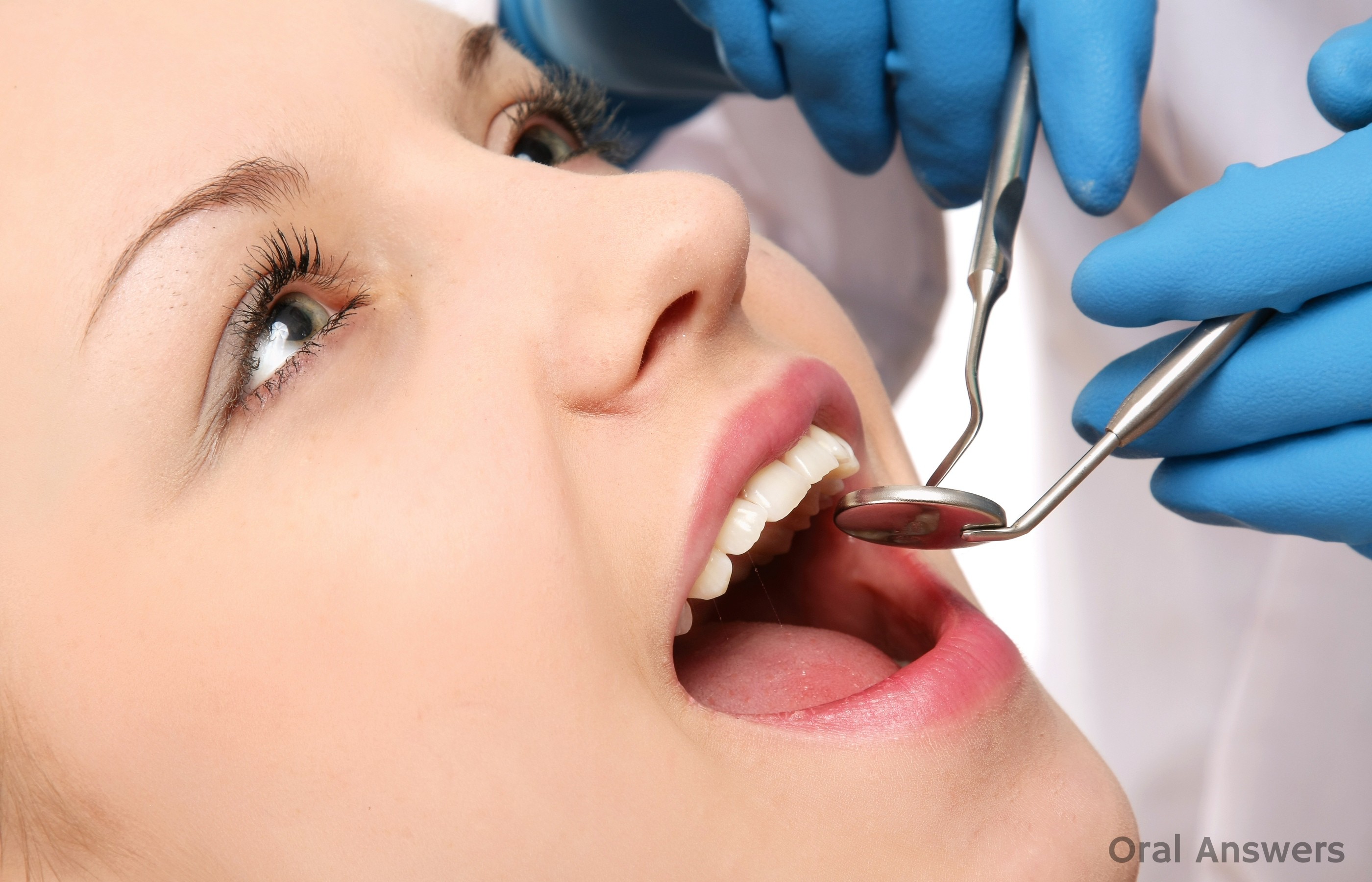 What Is a Comprehensive Dental Exam? Oral Answers