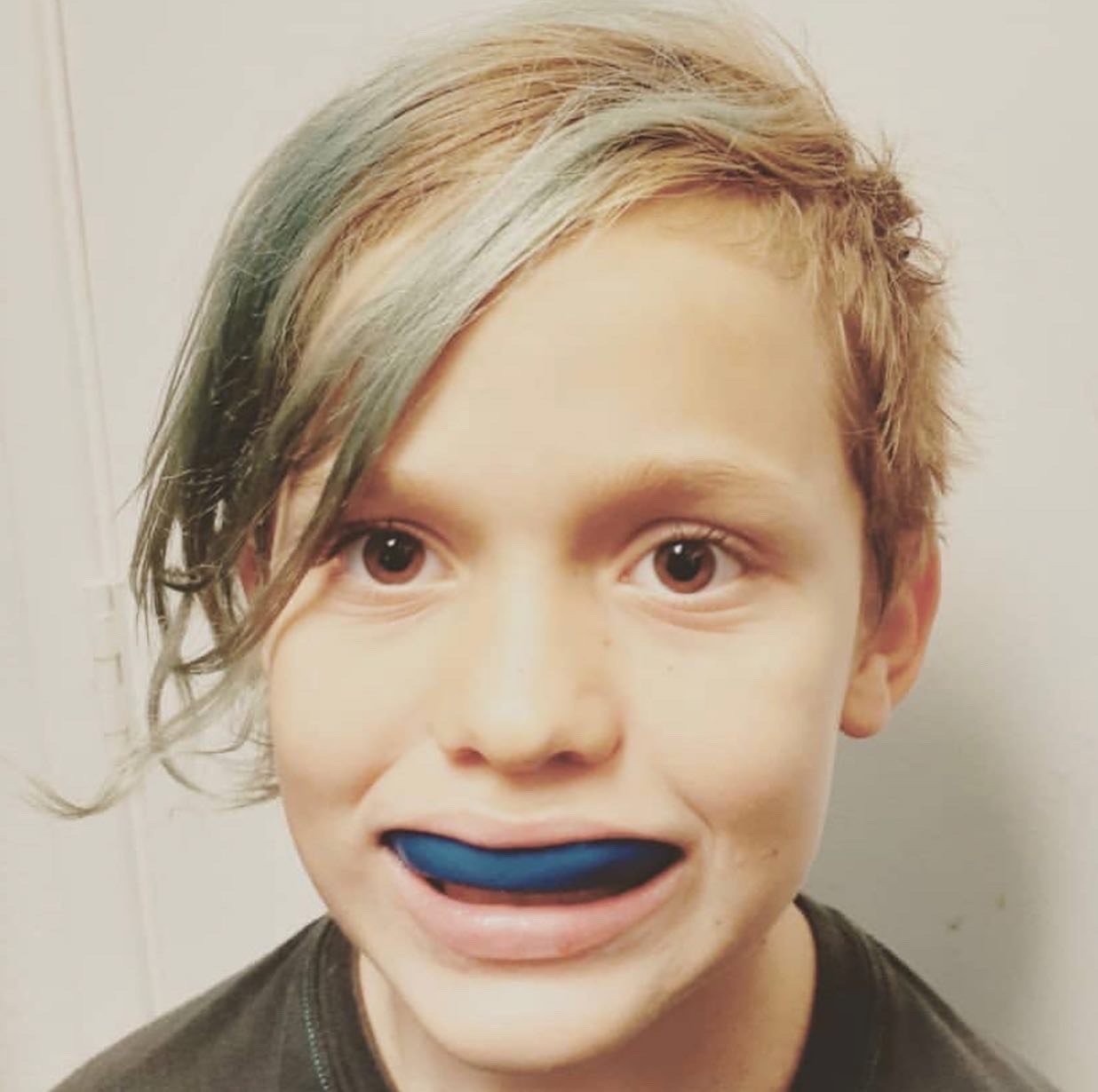 How to Mold a Mouth Guard StepbyStep Mouthguard Fitting Guide (with