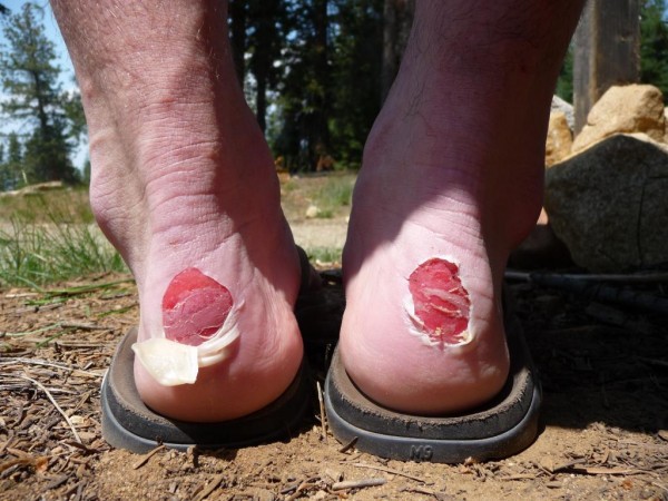 5 Reasons To Ditch Your Hiking Boots — CleverHiker