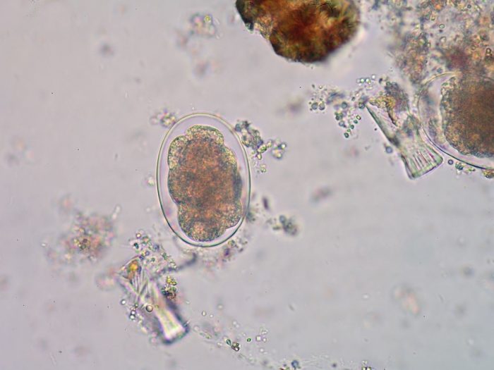 14 Effective Home Remedies for Hookworms Organic Facts