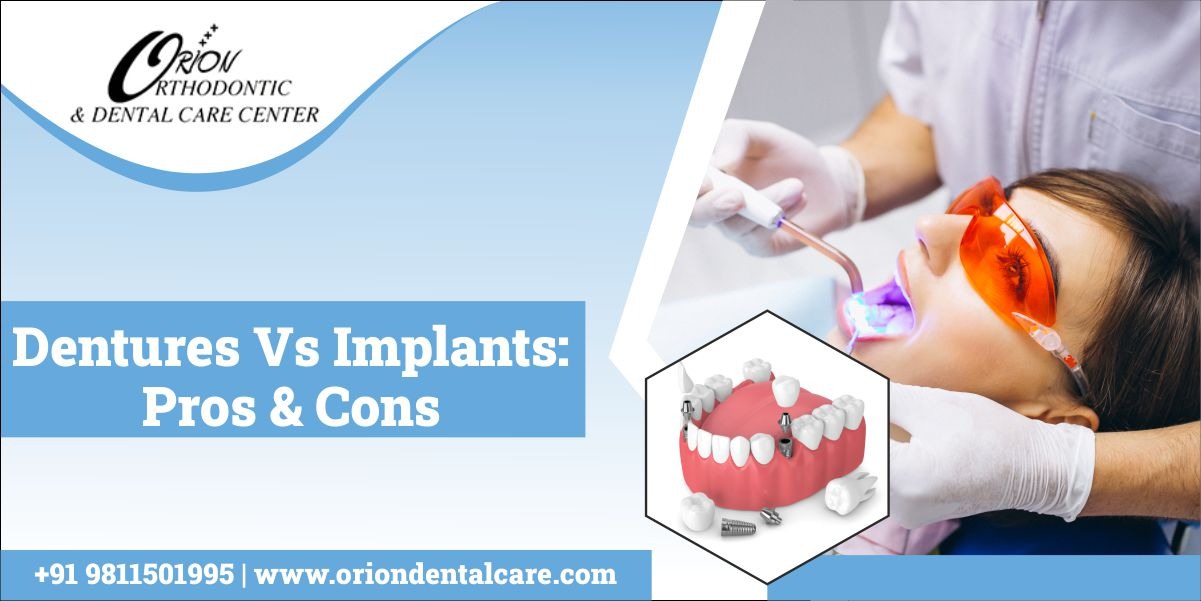 Dentures Vs. Implants Pros & Cons
