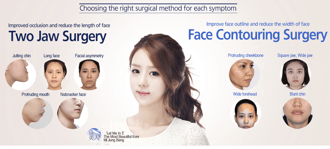 Orthognathic Surgery Medical Orofacial Surgery