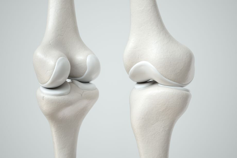 Cartilage 101 What Is Cartilage and What Does It Do? Orthopedic