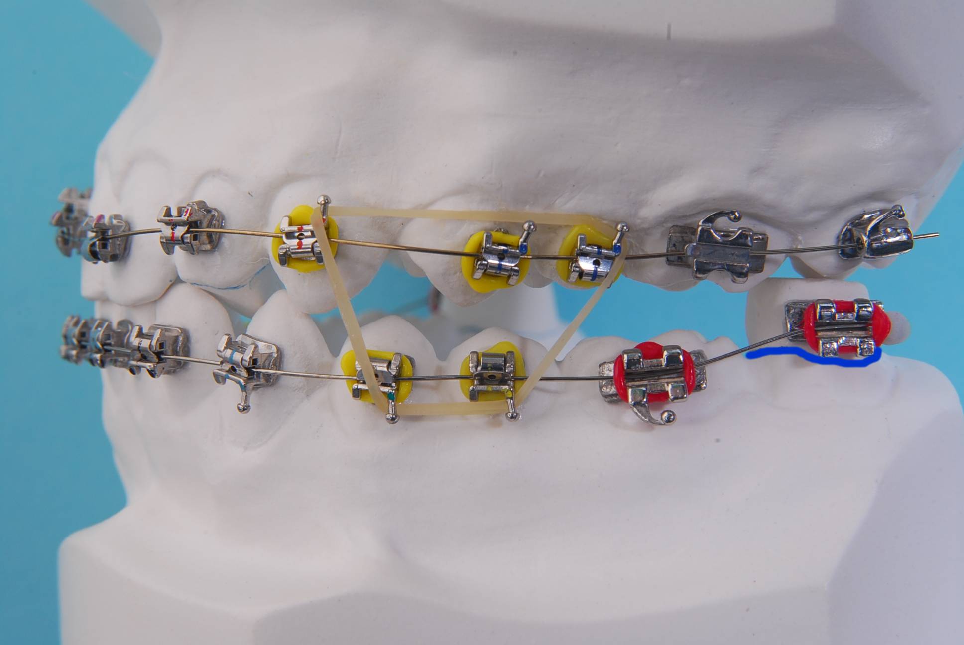 Rideau Orthodontic Mfg. Ltd. & Bonarch Supply Canada Ltd.