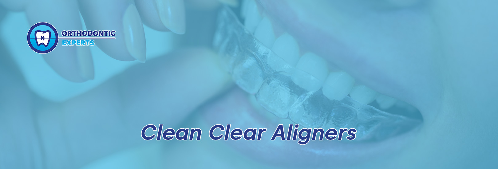 How to Clean Clear Retainers the Safe and Natural Way