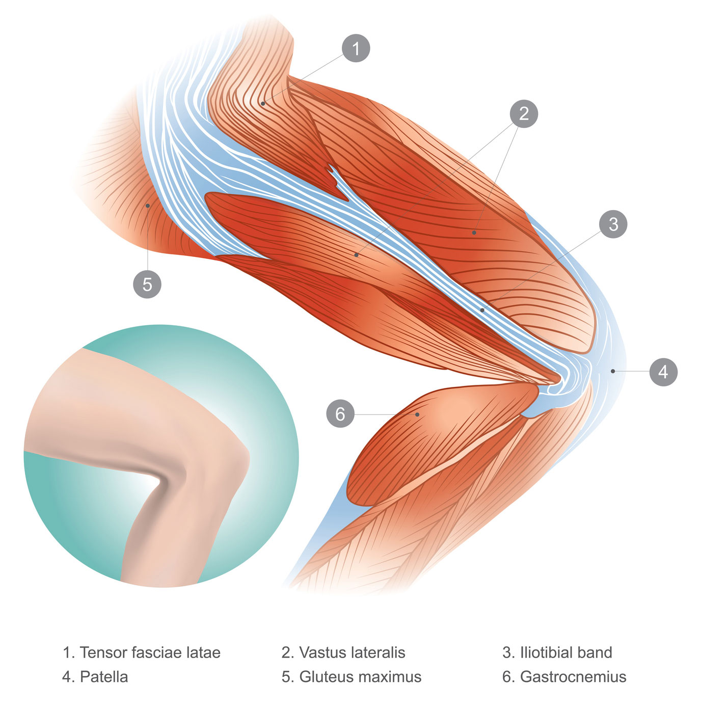 Iliotibial Band (IT Band) Syndrome - OrthoInfo - AAOS