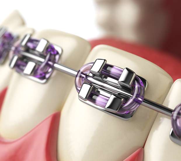 Privacy Practice Henry Orthodontics Pinehurst, North Carolina