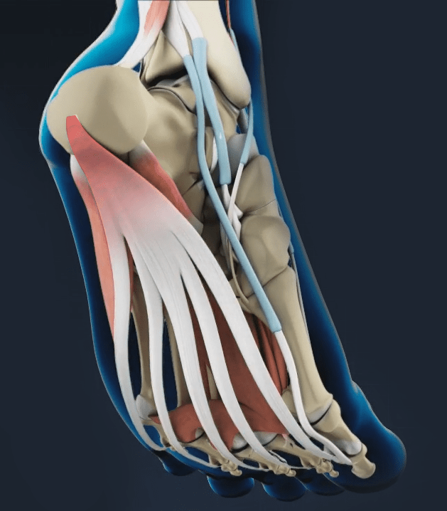 Plantar Fasciitis Memphis Foot Pain Treatments Memphis