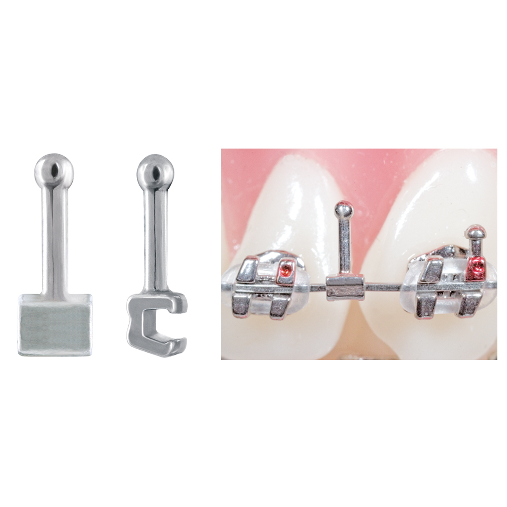 Crimpable Ball Hooks with Split Archwire Opening Ortho Technology