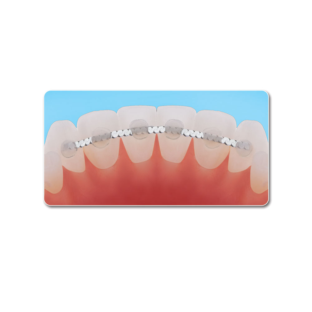 Gold Lingual Retainer Chain Ortho Technology