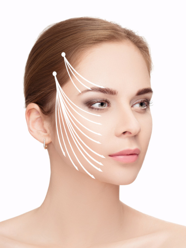 Hilos Tensores Estética Facial Madrid Dr. de la Peña