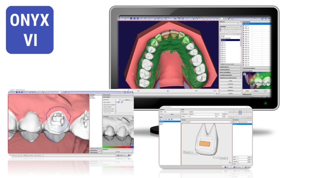 OnyxCeph³ VI Aligner Advanced OSCAndre Kranzusch