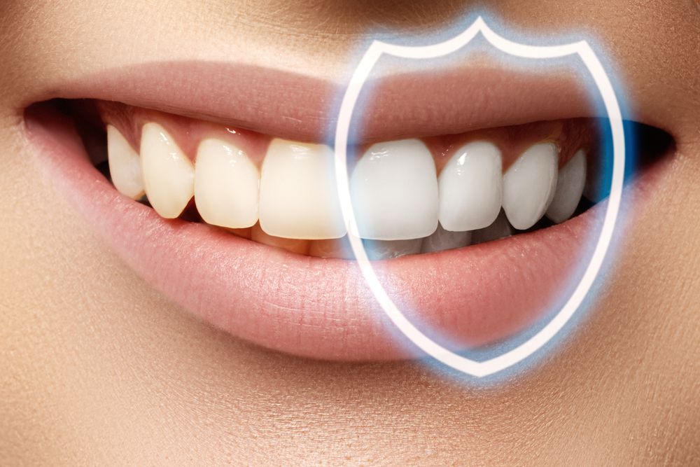 Teeth Whitening vs Teeth Bleaching What is the Best Procedure? North
