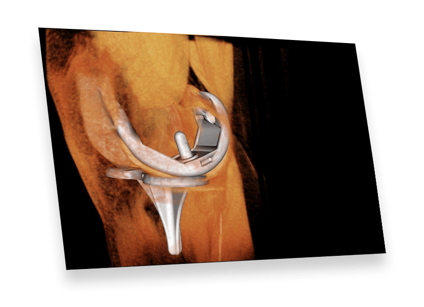 Medical Design Studio Osteoid Inc