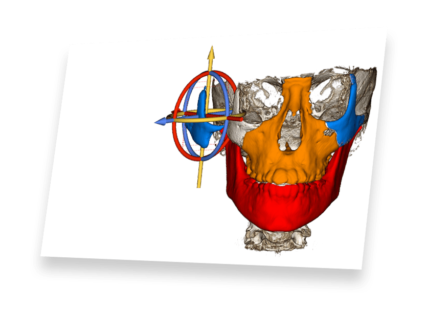 Medical Design Studio Osteoid Inc