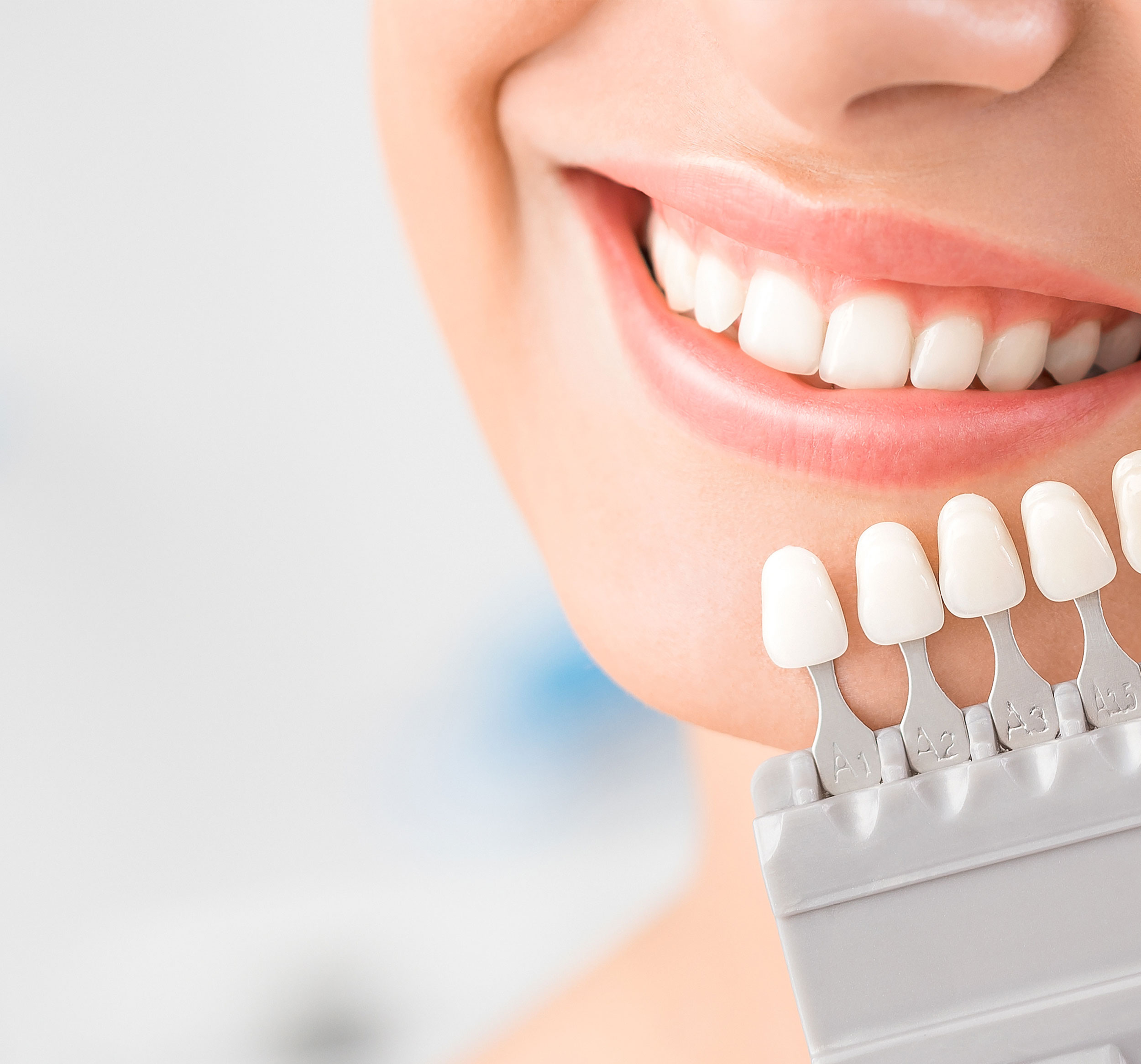 CutomShadeService Ottawa Dental Laboratory