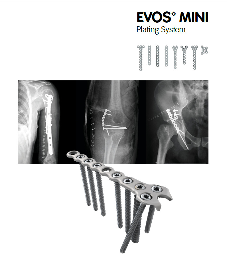 Evos mini